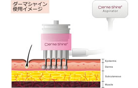 ダーマシャイン使用イメージ